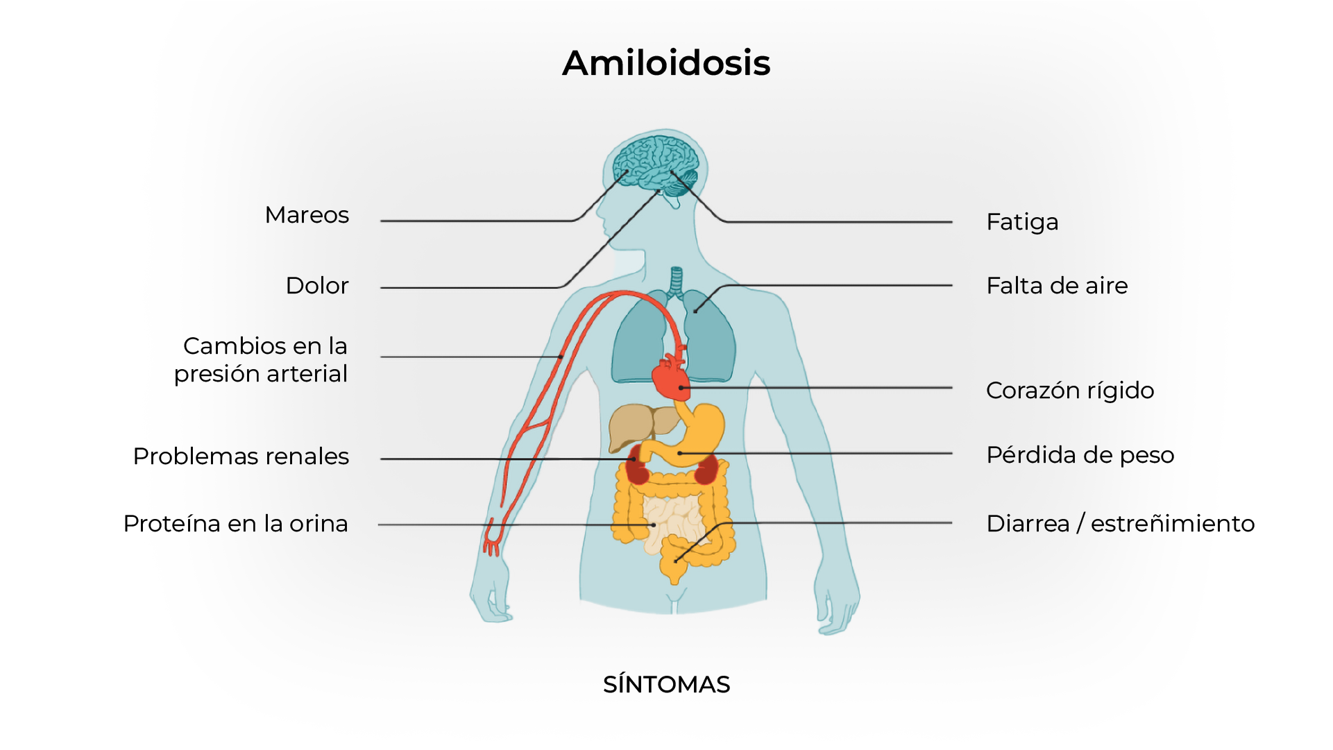 Comparación de conteo normal vs. anemia