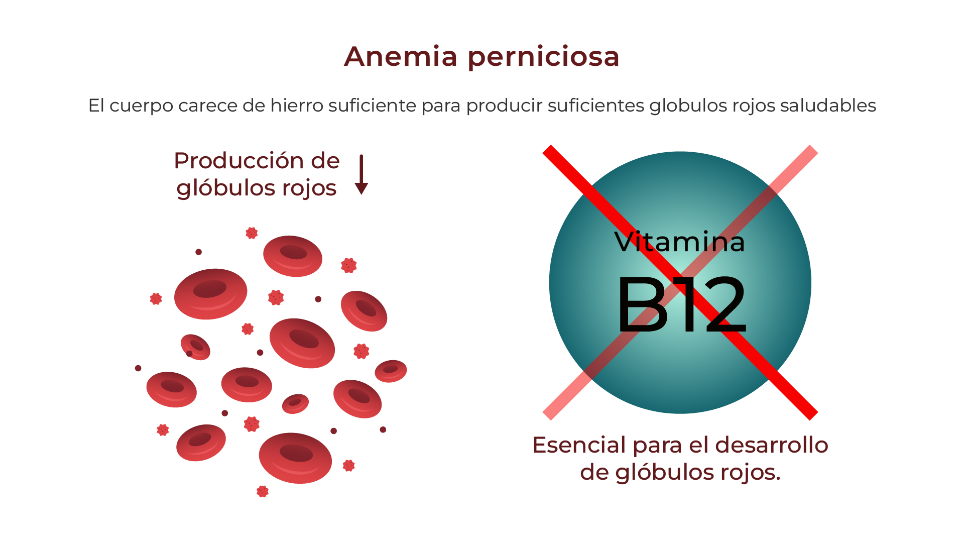 Anemia perniciosa / deficiencia de B12 y folato
