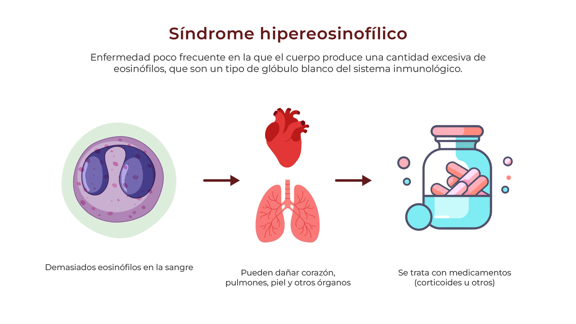 Síndrome hipereosinofílico
