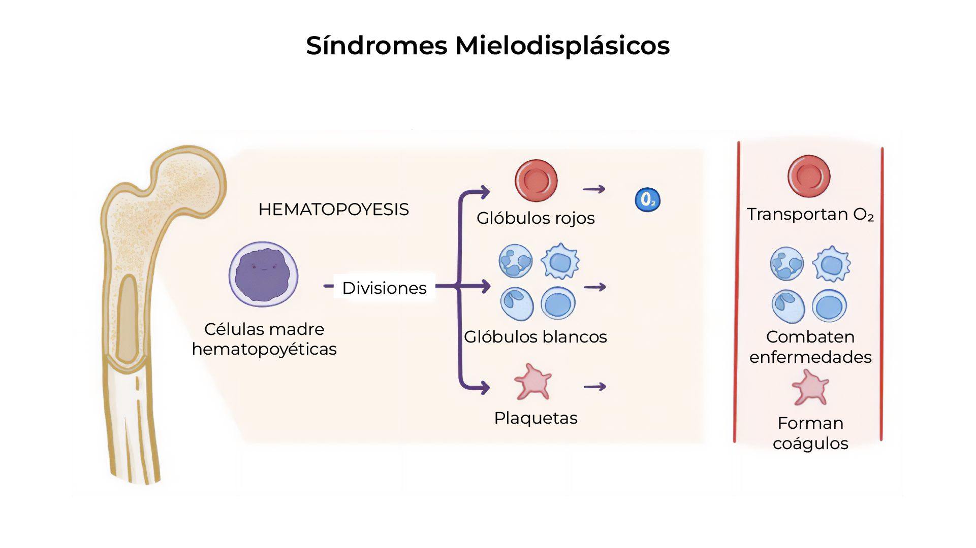Comparación de conteo normal vs. anemia