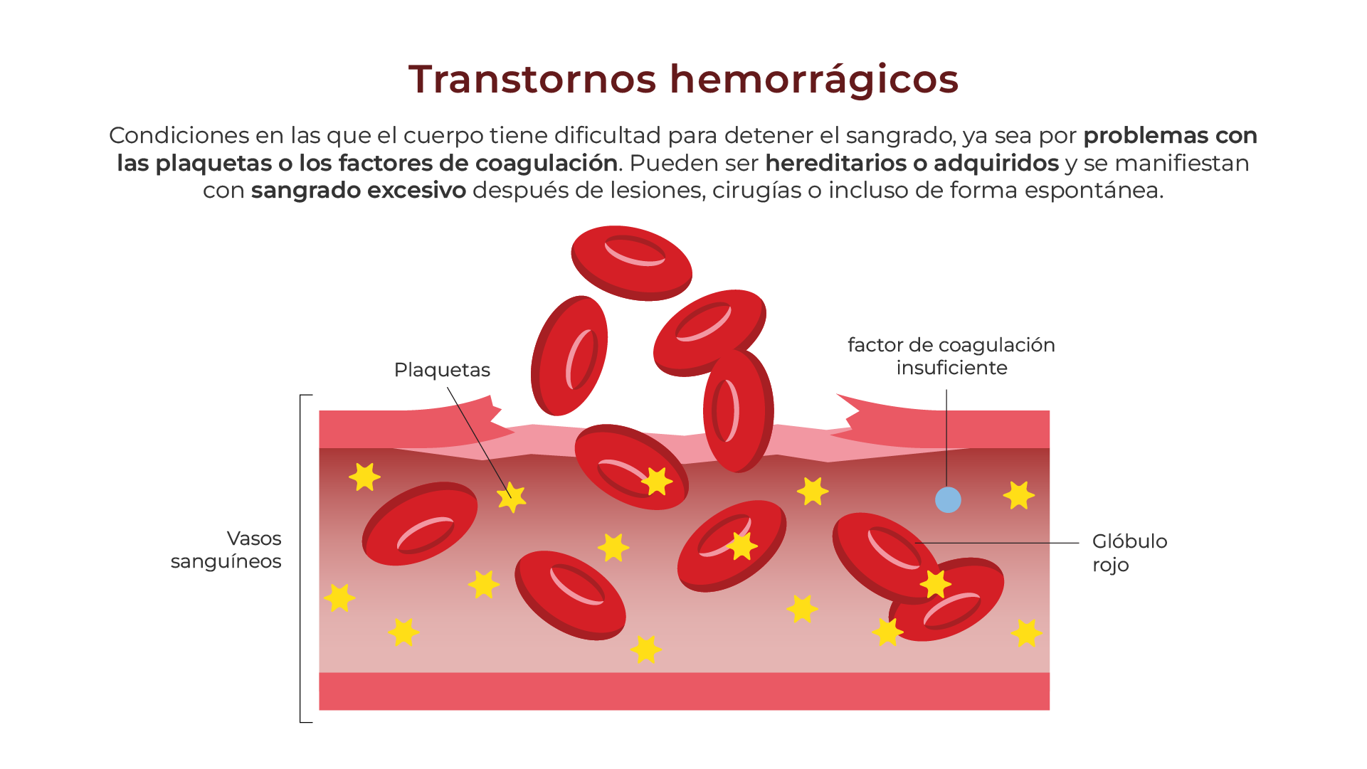 Trastornos hemorrágicos y de la coagulación