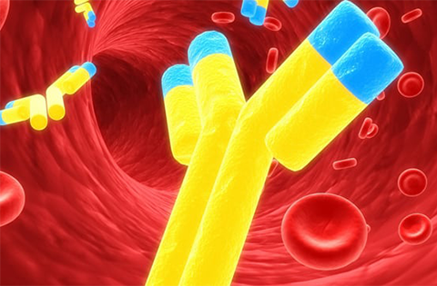 Macroglobulinemia de Waldenström
