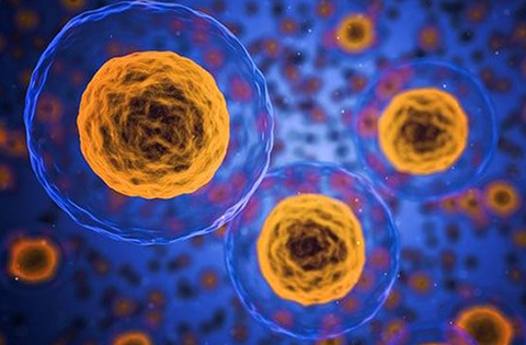 Mastocitosis sistémica